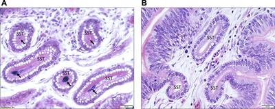 Prolonged repeated inseminations trigger a local immune response and accelerate aging of the uterovaginal junction in turkey hens